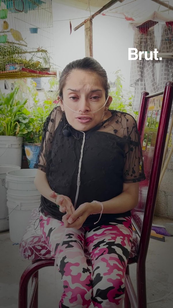 “La gente no valora respirar gratis”: la historia de Yaniz