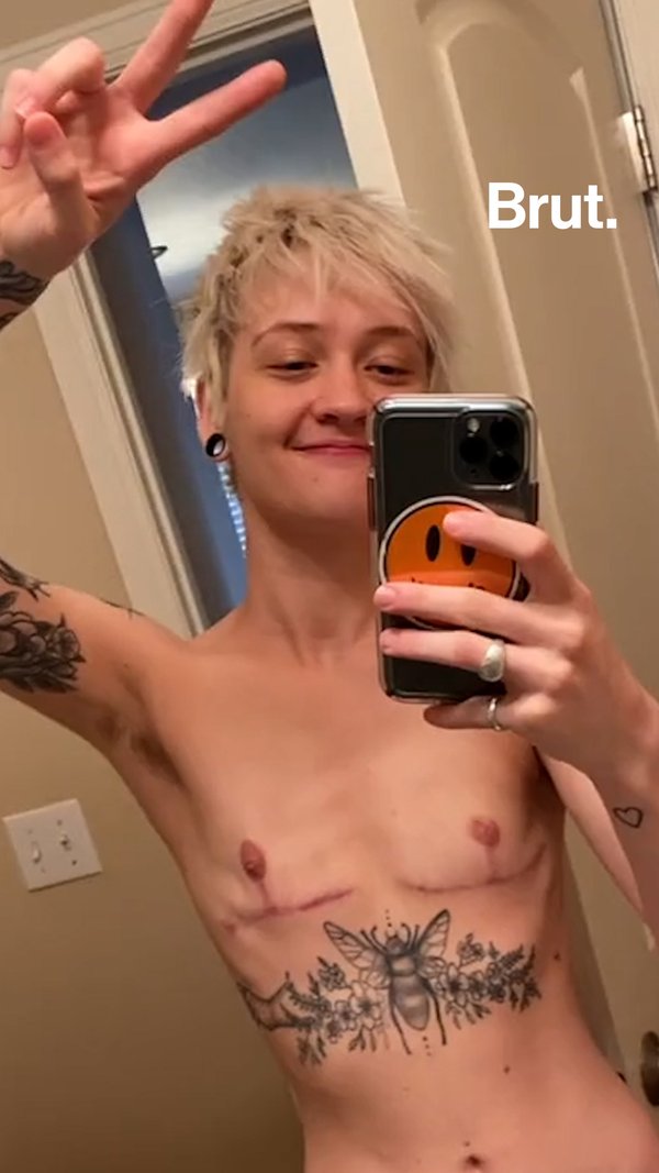 This trans man shared his transition story